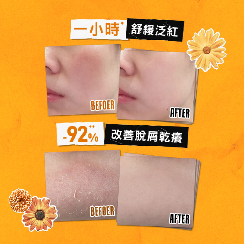 金盞花B5保濕修護精華乳液 首罐超越B5的B群乳液乳霜