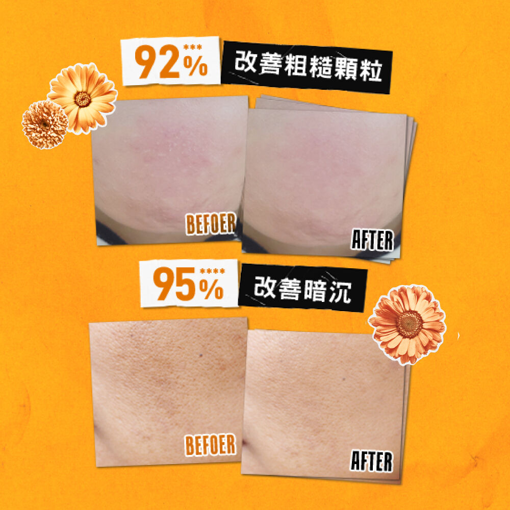 金盞花B5保濕修護精華乳液 首罐超越B5的B群乳液乳霜