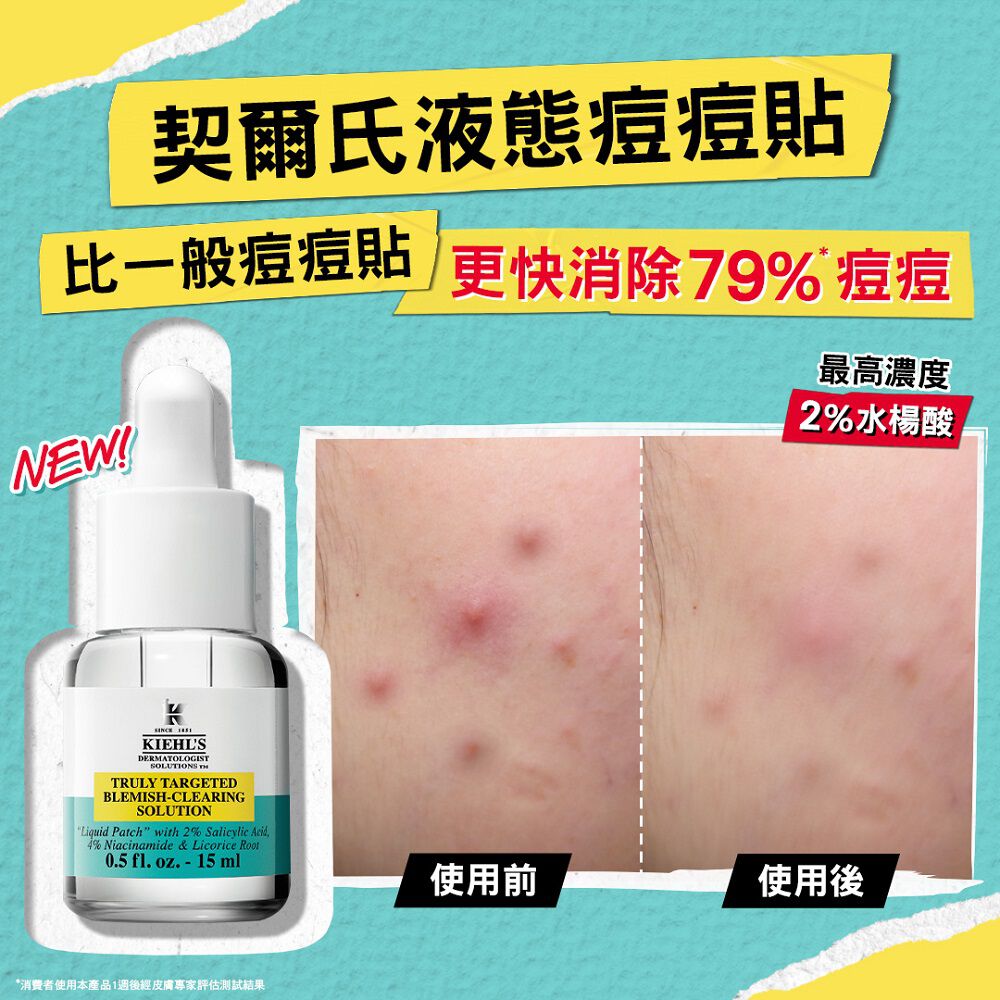 2%水楊酸痘痘精華露 痘痘貼推薦／1瓶消300顆痘痘