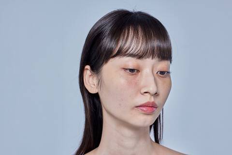 敏感肌的原因介紹