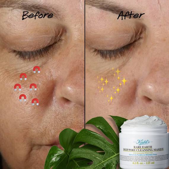 毛孔粗大保養方式介紹