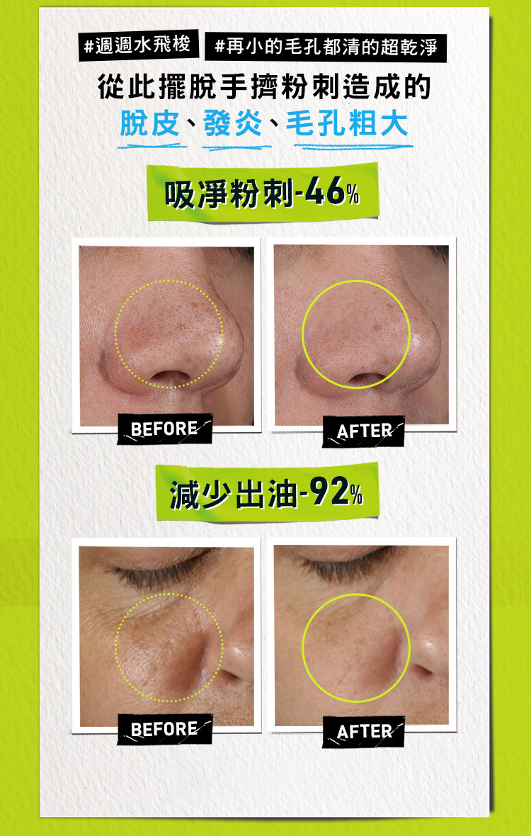 亞馬遜白泥淨緻毛孔面膜