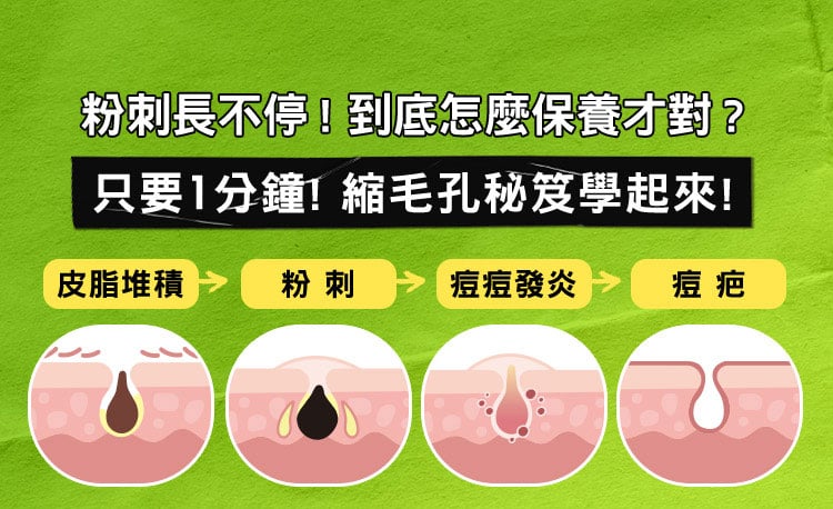 痘痘長不停! 到底怎麼保養才對?​