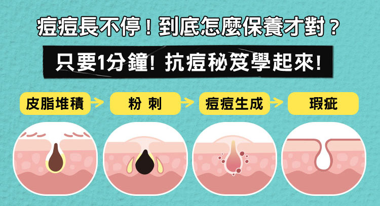 痘痘長不停! 到底怎麼保養才對?​