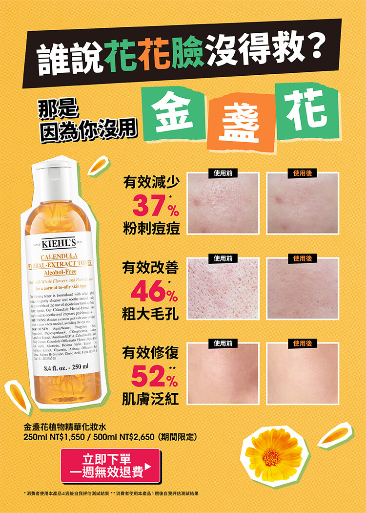 誰說花花臉沒得救？那是因為你沒用金盞花