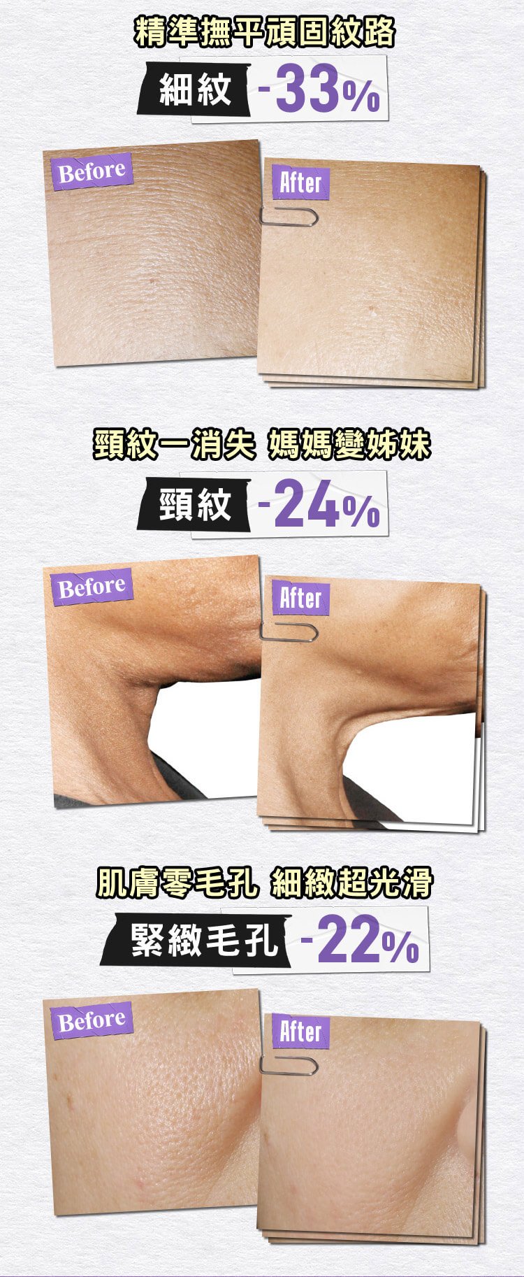 A醇全能新生抗痕精華