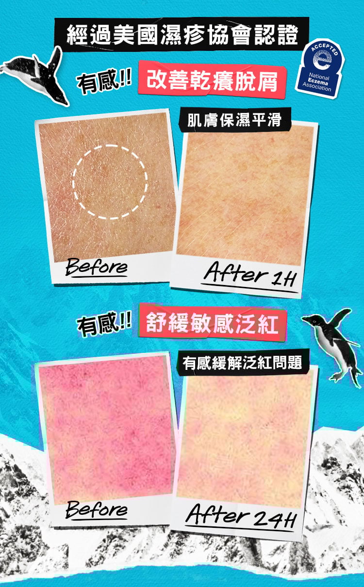 冰河醣蛋白舒敏修護保濕霜
