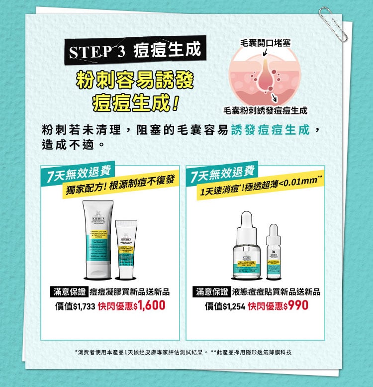 粉刺發炎化膿，就是痘痘!​