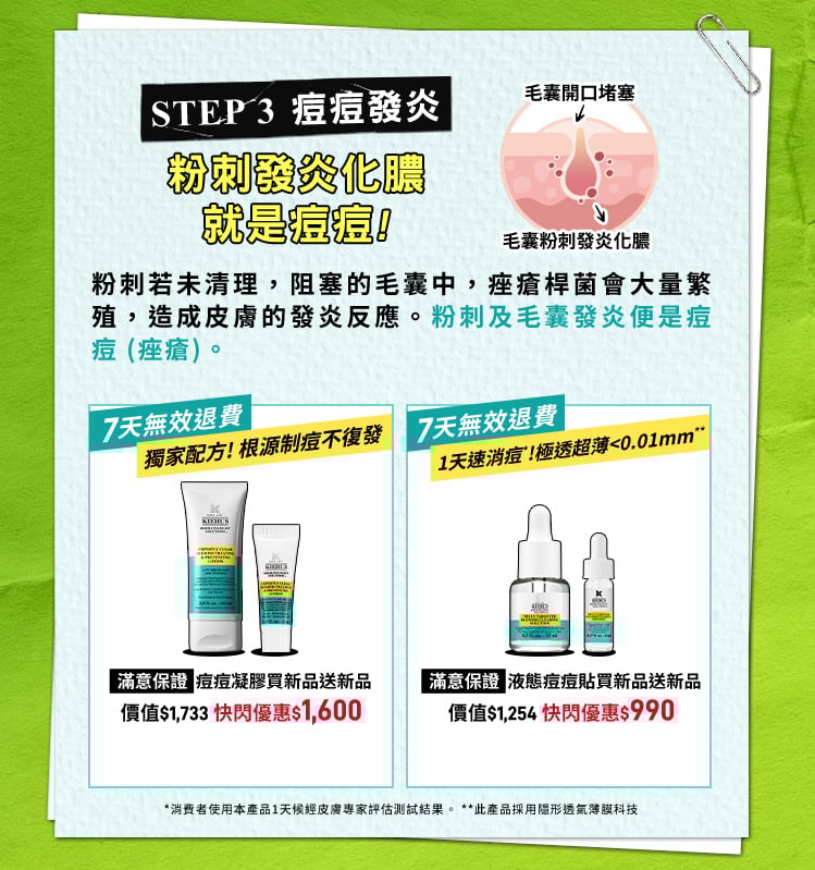 粉刺發炎化膿，就是痘痘!​