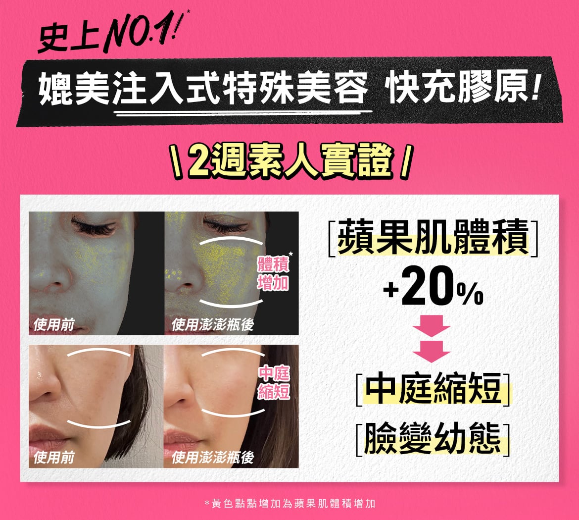 NEW契爾氏澎澎瓶