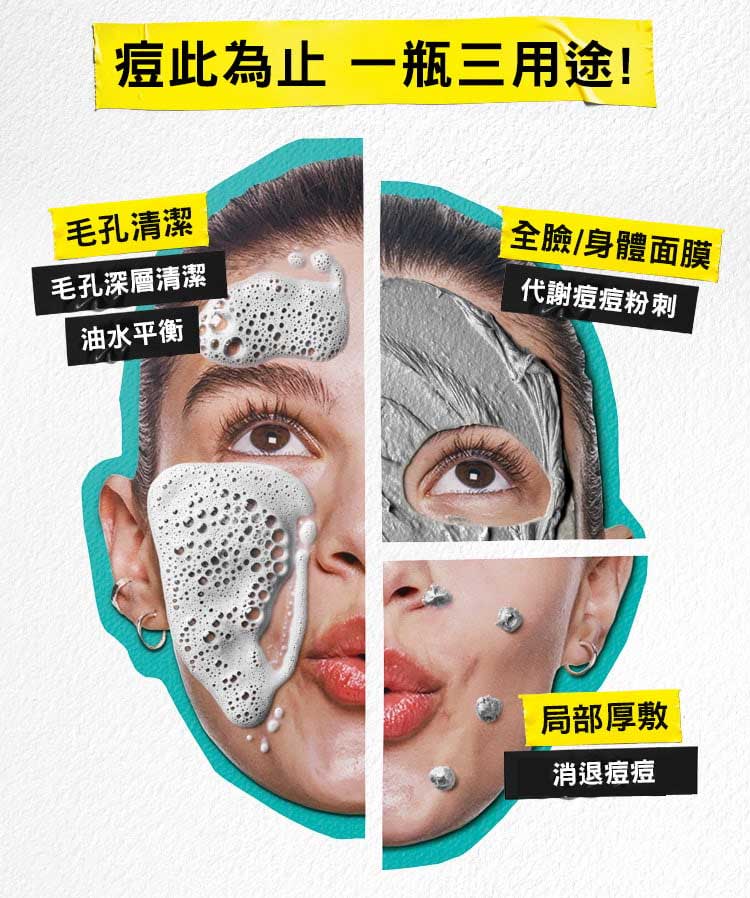 2%水楊酸三合一淨痘潔膚乳