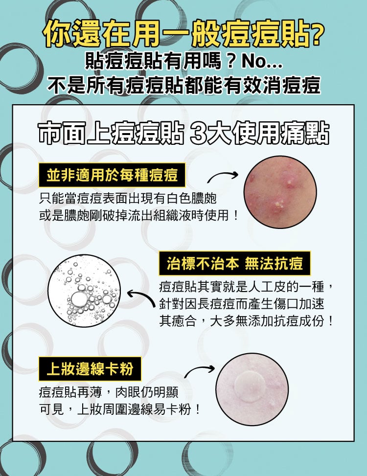 你還在用一般痘痘貼?